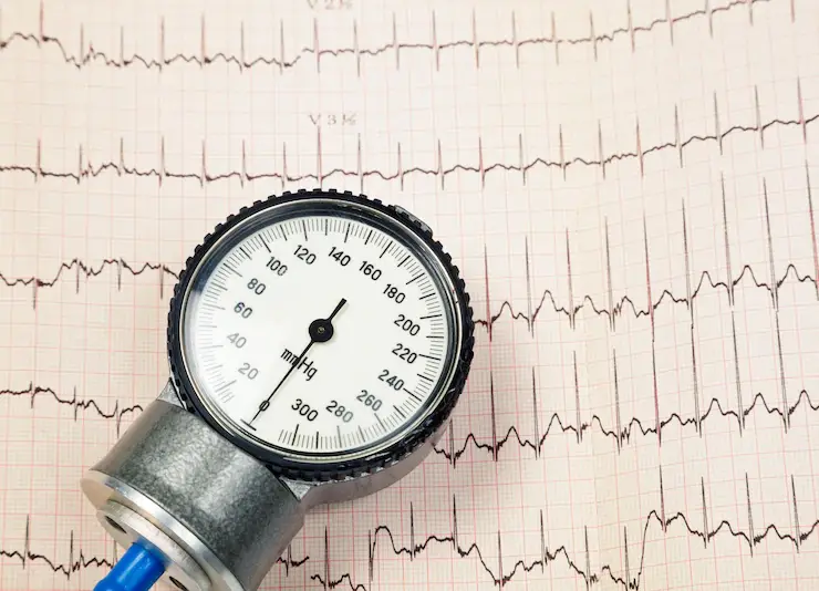 sphygmomanometer aneroid