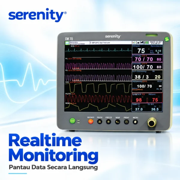 Tampilan waveform Patient Monitor Serenity CM70